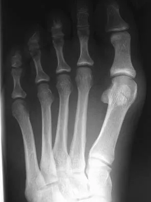 General Orthopedics 2026 Practice Questions: Set 3 (Solved) - Figure 24