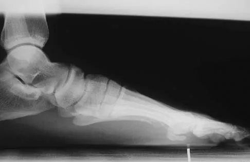 General Orthopedics 2026 Practice Questions: Set 3 (Solved) - Figure 25