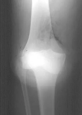 General Orthopedics 2026 Practice Questions: Set 3 (Solved) - Figure 28