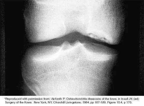 General Orthopedics 2026 Practice Questions: Set 3 (Solved) - Figure 30