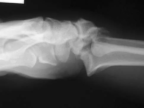 General Orthopedics 2026 Practice Questions: Set 3 (Solved) - Figure 39