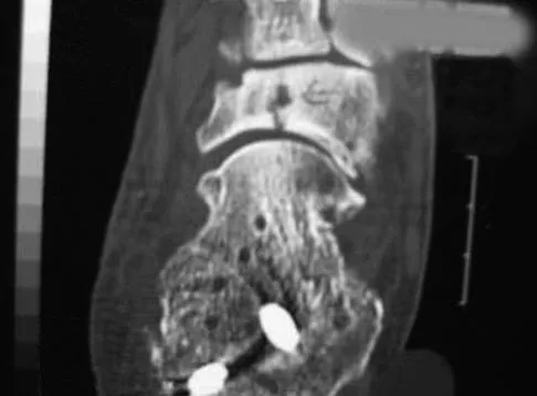 General Orthopedics 2026 Practice Questions: Set 3 (Solved) - Figure 43