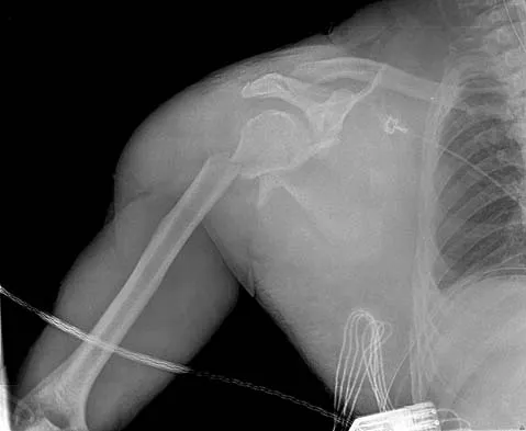 General Orthopedics 2026 Practice Questions: Set 3 (Solved) - Figure 54