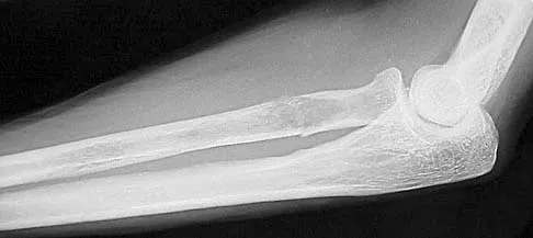 General Orthopedics 2026 Practice Questions: Set 3 (Solved) - Figure 60