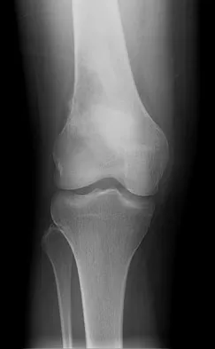 General Orthopedics 2026 Practice Questions: Set 3 (Solved) - Figure 69