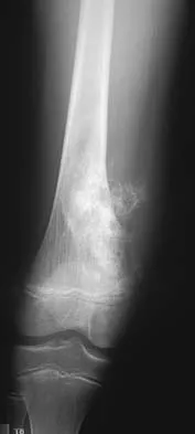 General Orthopedics 2026 Practice Questions: Set 3 (Solved) - Figure 70