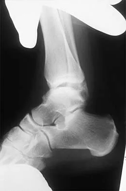 General Orthopedics 2026 Practice Questions: Set 3 (Solved) - Figure 71