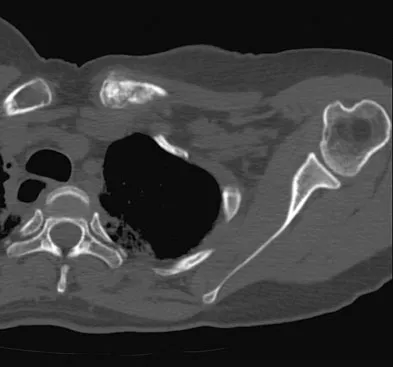 General Orthopedics 2026 Practice Questions: Set 3 (Solved) - Figure 76