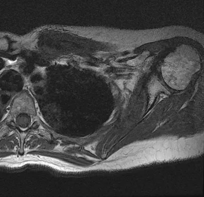 General Orthopedics 2026 Practice Questions: Set 3 (Solved) - Figure 77