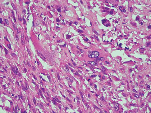 General Orthopedics 2026 Practice Questions: Set 3 (Solved) - Figure 78