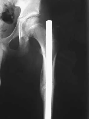 General Orthopedics 2026 Practice Questions: Set 3 (Solved) - Figure 81