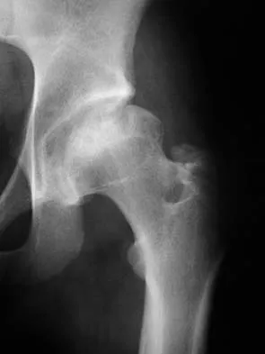 General Orthopedics 2026 Practice Questions: Set 3 (Solved) - Figure 82