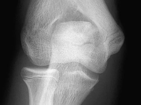 General Orthopedics 2026 Practice Questions: Set 3 (Solved) - Figure 83