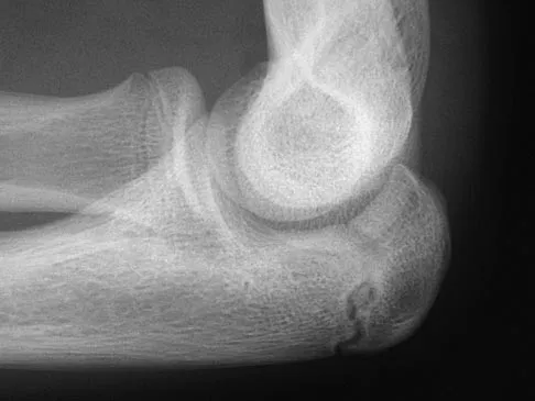 General Orthopedics 2026 Practice Questions: Set 3 (Solved) - Figure 84