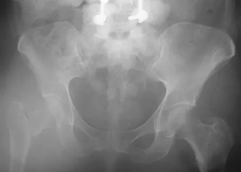 General Orthopedics 2026 Practice Questions: Set 3 (Solved) - Figure 86