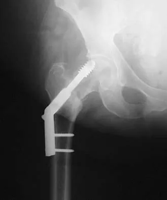 General Orthopedics 2026 Practice Questions: Set 3 (Solved) - Figure 87