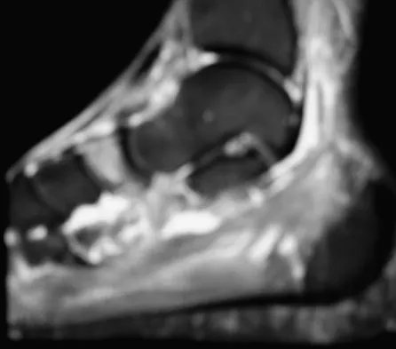 General Orthopedics 2026 Practice Questions: Set 3 (Solved) - Figure 90