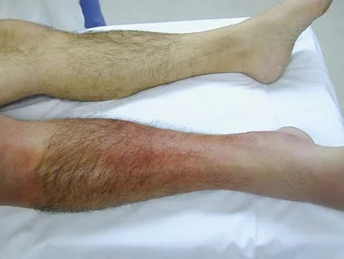 General Orthopedics 2026 Practice Questions: Set 3 (Solved) - Figure 92