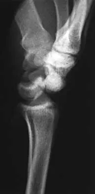 General Orthopedics 2026 Practice Questions: Set 3 (Solved) - Figure 94