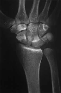 General Orthopedics 2026 Practice Questions: Set 3 (Solved) - Figure 95