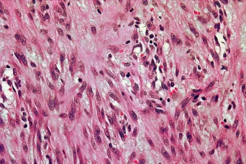 General Orthopedics 2026 Practice Questions: Set 3 (Solved) - Figure 98