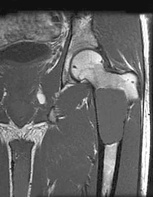 General Orthopedics Board Review 2026: High-Yield MCQs (Set 4) - Figure 11