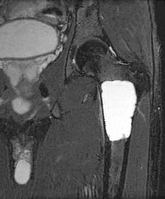 General Orthopedics Board Review 2026: High-Yield MCQs (Set 4) - Figure 12