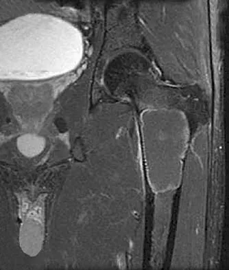 General Orthopedics Board Review 2026: High-Yield MCQs (Set 4) - Figure 13