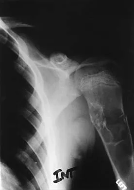 General Orthopedics Board Review 2026: High-Yield MCQs (Set 4) - Figure 14