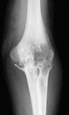 General Orthopedics Board Review 2026: High-Yield MCQs (Set 4) - Figure 16