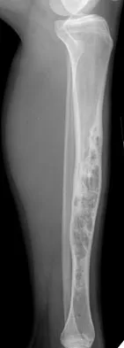 General Orthopedics Board Review 2026: High-Yield MCQs (Set 4) - Figure 24