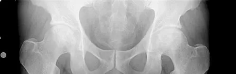 General Orthopedics Board Review 2026: High-Yield MCQs (Set 4) - Figure 29