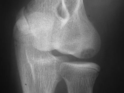 General Orthopedics Board Review 2026: High-Yield MCQs (Set 4) - Figure 3
