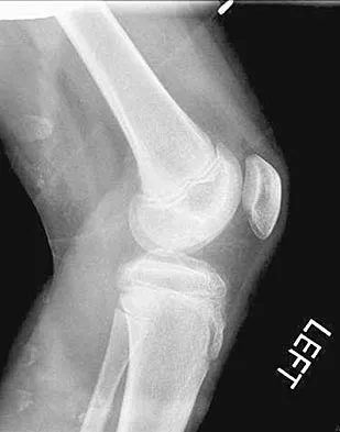 General Orthopedics Board Review 2026: High-Yield MCQs (Set 4) - Figure 32
