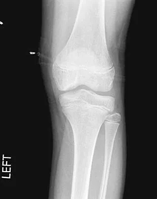 General Orthopedics Board Review 2026: High-Yield MCQs (Set 4) - Figure 34
