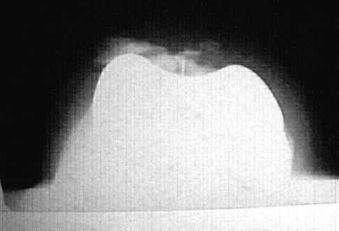 General Orthopedics Board Review 2026: High-Yield MCQs (Set 4) - Figure 35