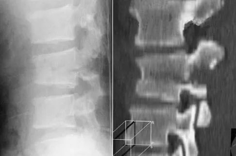 General Orthopedics Board Review 2026: High-Yield MCQs (Set 4) - Figure 41