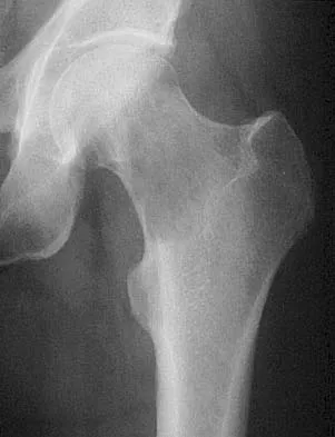 General Orthopedics Board Review 2026: High-Yield MCQs (Set 4) - Figure 42