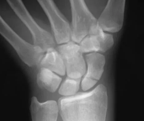 General Orthopedics Board Review 2026: High-Yield MCQs (Set 4) - Figure 49