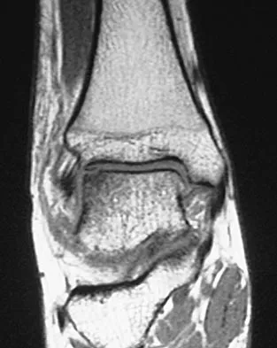 General Orthopedics Board Review 2026: High-Yield MCQs (Set 4) - Figure 54