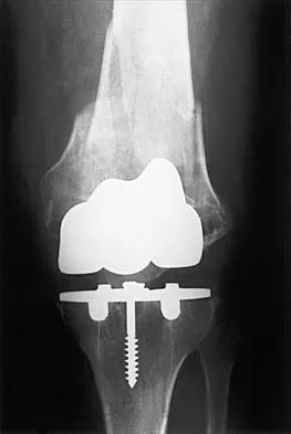 General Orthopedics Board Review 2026: High-Yield MCQs (Set 4) - Figure 59