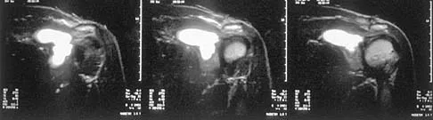 General Orthopedics Board Review 2026: High-Yield MCQs (Set 4) - Figure 70