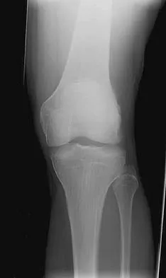 General Orthopedics Board Review 2026: High-Yield MCQs (Set 4) - Figure 73