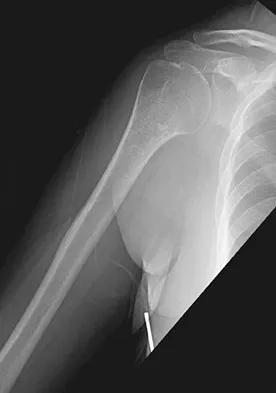 General Orthopedics Board Review 2026: High-Yield MCQs (Set 4) - Figure 76