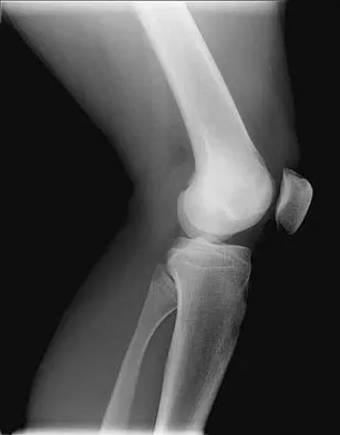 General Orthopedics Board Review 2026: High-Yield MCQs (Set 4) - Figure 79