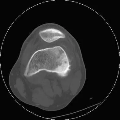 General Orthopedics Board Review 2026: High-Yield MCQs (Set 4) - Figure 81