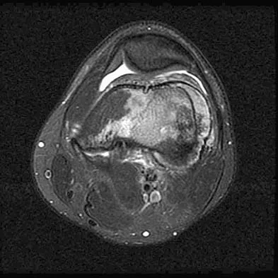 General Orthopedics Board Review 2026: High-Yield MCQs (Set 4) - Figure 82