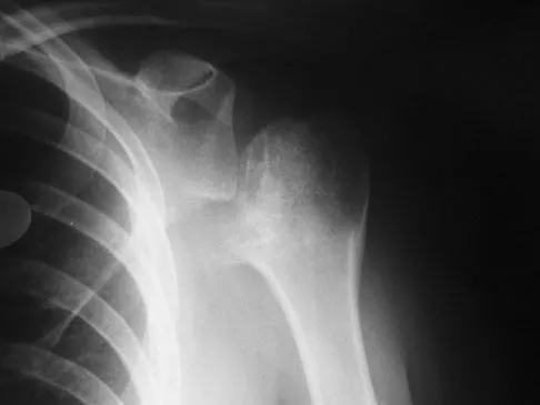 General Orthopedics Board Review 2026: High-Yield MCQs (Set 4) - Figure 84