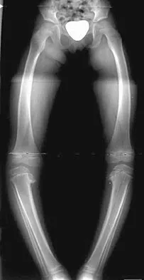 General Orthopedics Board Review 2026: High-Yield MCQs (Set 4) - Figure 85