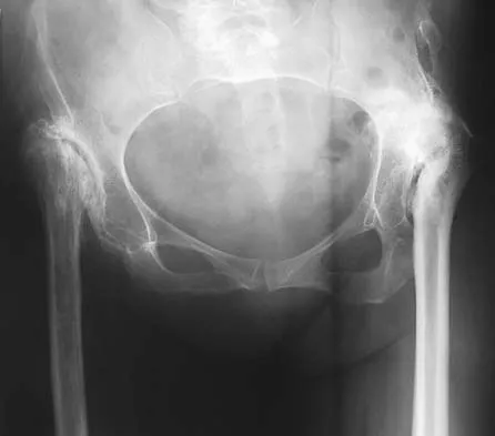 General Orthopedics Board Review 2026: High-Yield MCQs (Set 4) - Figure 87